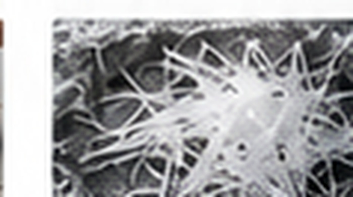 Fiber Reinforcement